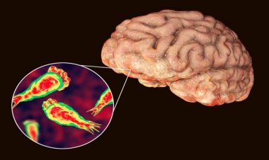 Kerala Confirms 67 Cases and 18 Deaths from Brain-Eating Amoeba in 2025