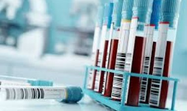 Abu Dhabi introduces advanced cancer screening with Trucheck Intelli blood test